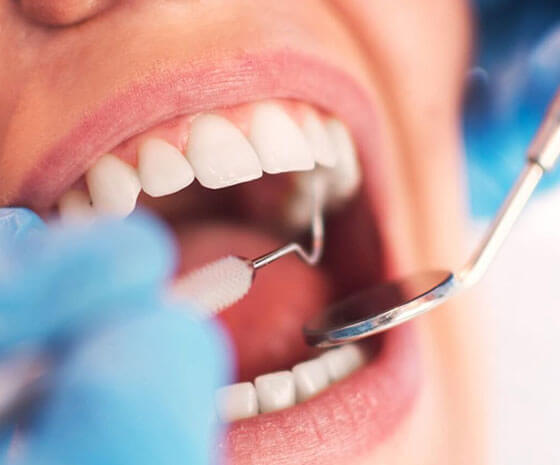 Close-up of dental examination showing healthy white teeth with dentist tools during gum grafting procedure.