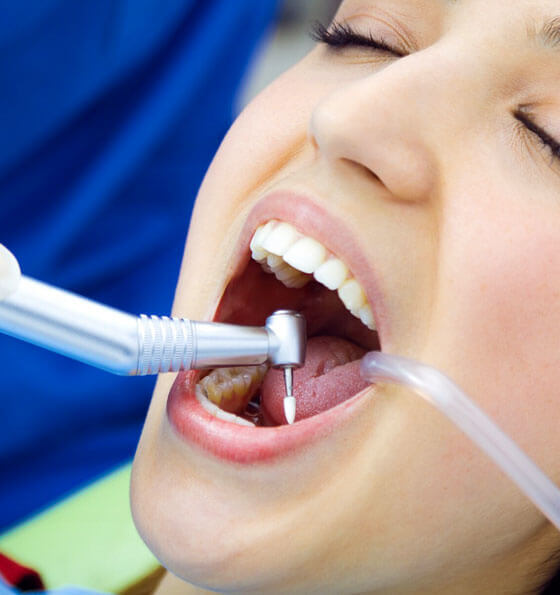 Patient receiving intraoral suction during dental treatment at Portland dental office.