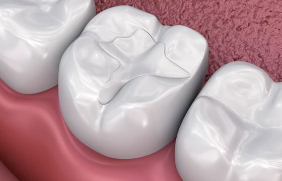 3D illustration of healthy teeth and gums showing proper dental anatomy and oral health.