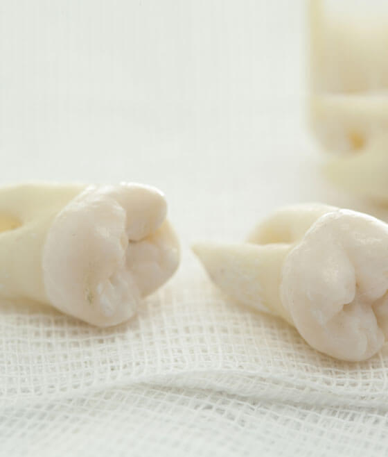 Extracted teeth models displayed on gauze for dental patient education.