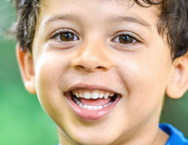 Happy young boy smiling brightly, showing healthy teeth for pediatric dental care.