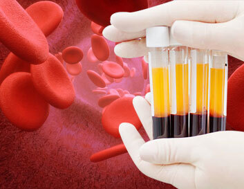 Platelet rich plasma samples in test tubes used for advanced dental regenerative treatments.