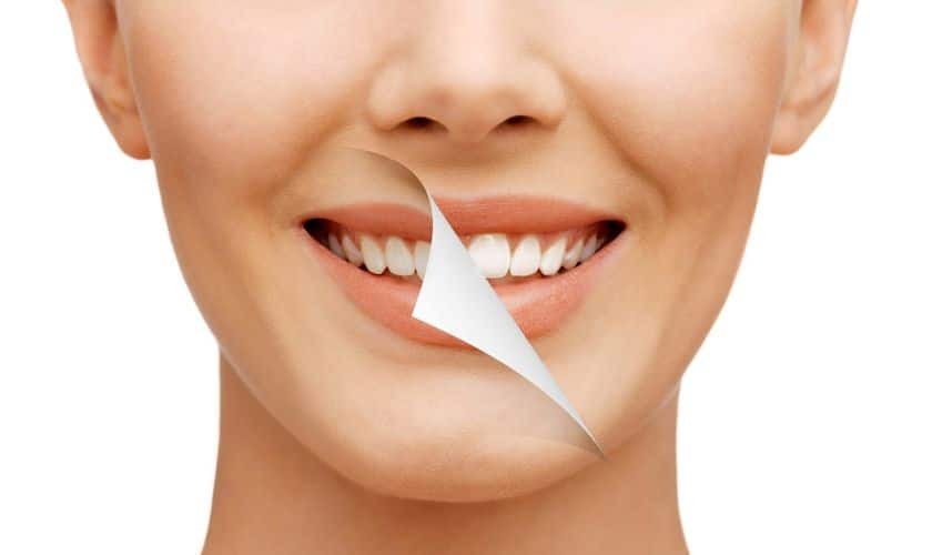 Featured image for “Cosmetic Dentistry Procedures That Can Make Your Smile Look Perfect”