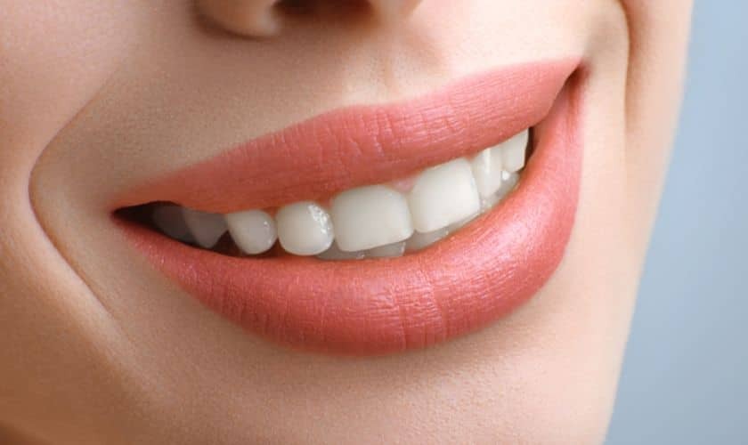 Featured image for “Teeth Whitening: Understanding the Basics for a Radiant Smile”