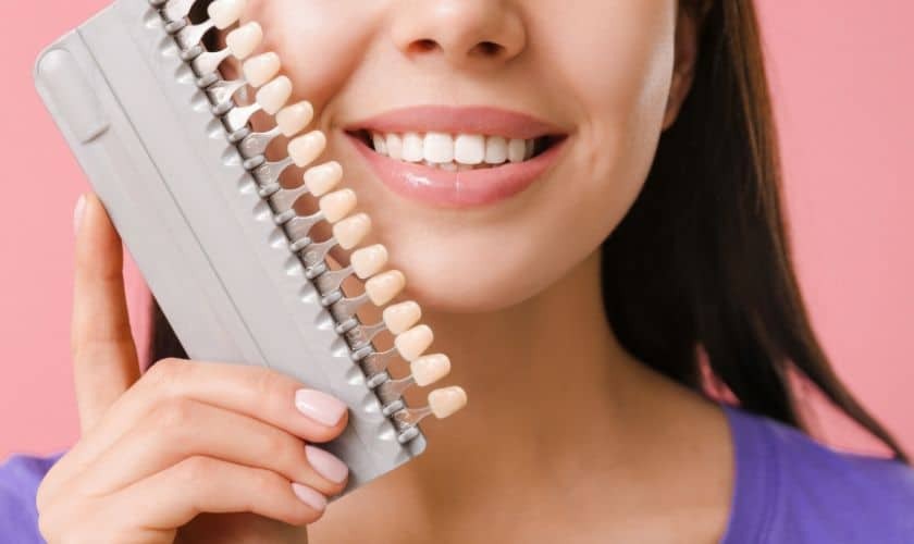 Featured image for “Veneers Through Time: Evolution and Advancements”