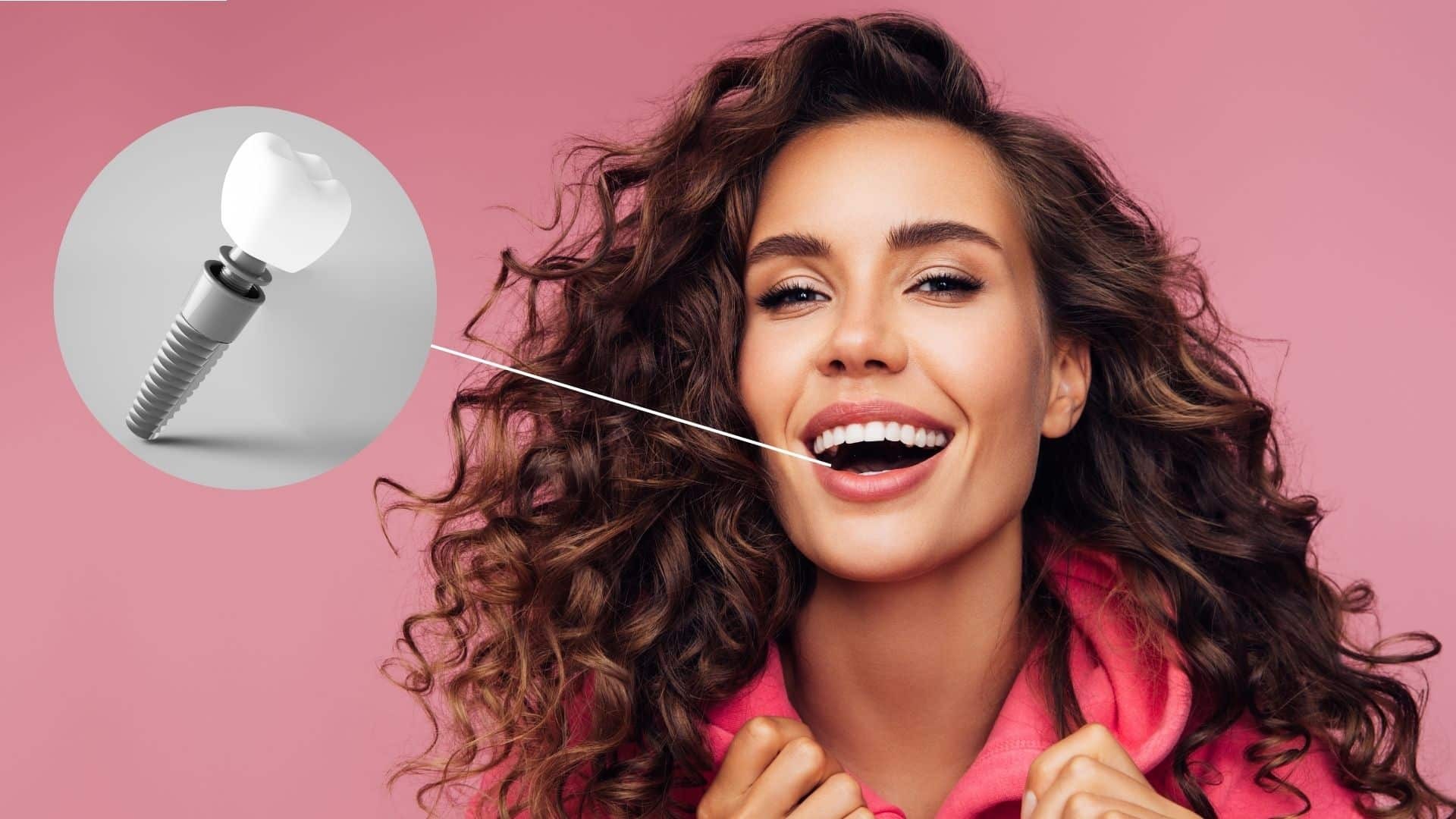 Featured image for “What Are the Different Types of Dental Implants Available?”