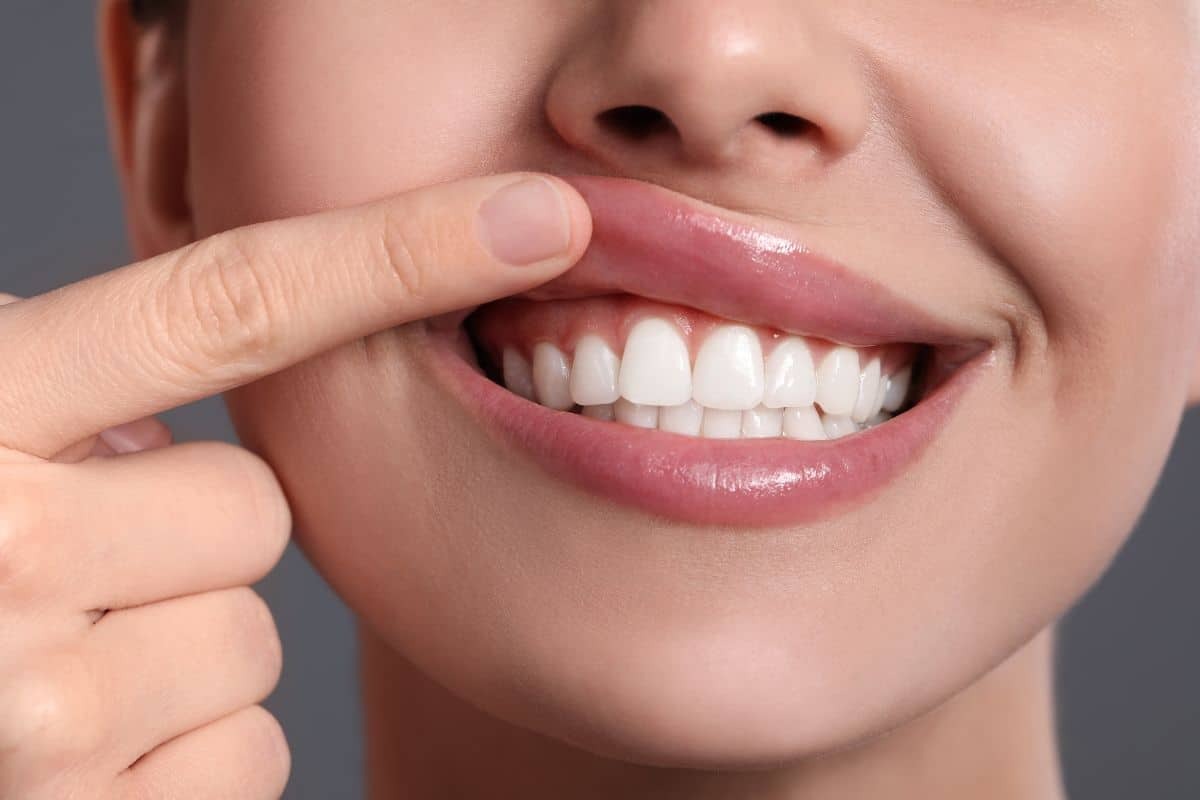 Featured image for “Can You Get Gum Contouring With Braces?”