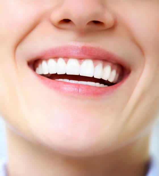 Teeth Whitening in Portland