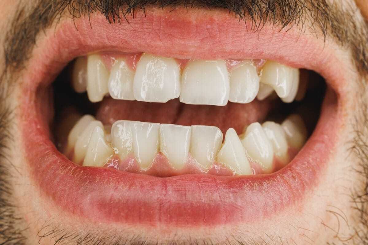 Featured image for “Cracked Tooth? Here’s How Cosmetic Dentistry Can Restore Your Smile”