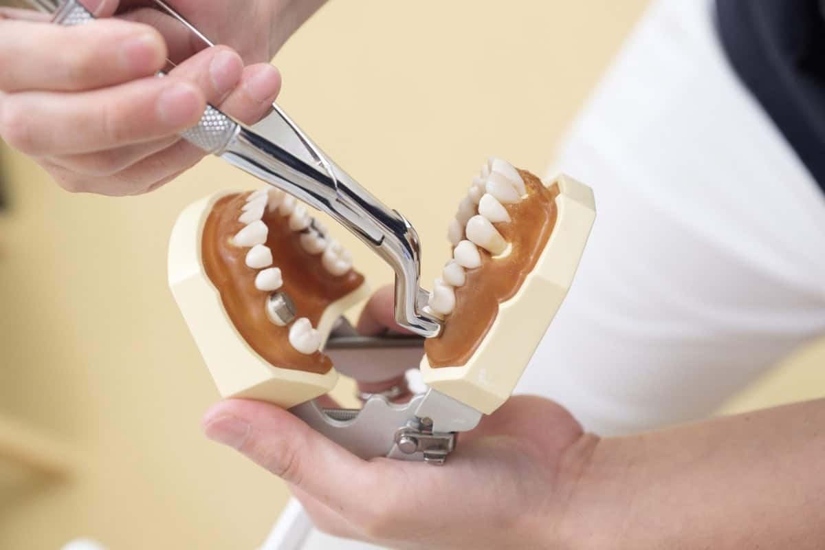 Featured image for “Is Tooth Extraction Safe for Heart Patients?”