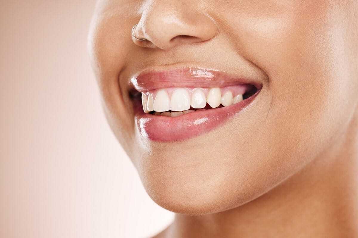 Featured image for “Natural vs. Cosmetic Dental Solutions: What’s Right for You?”