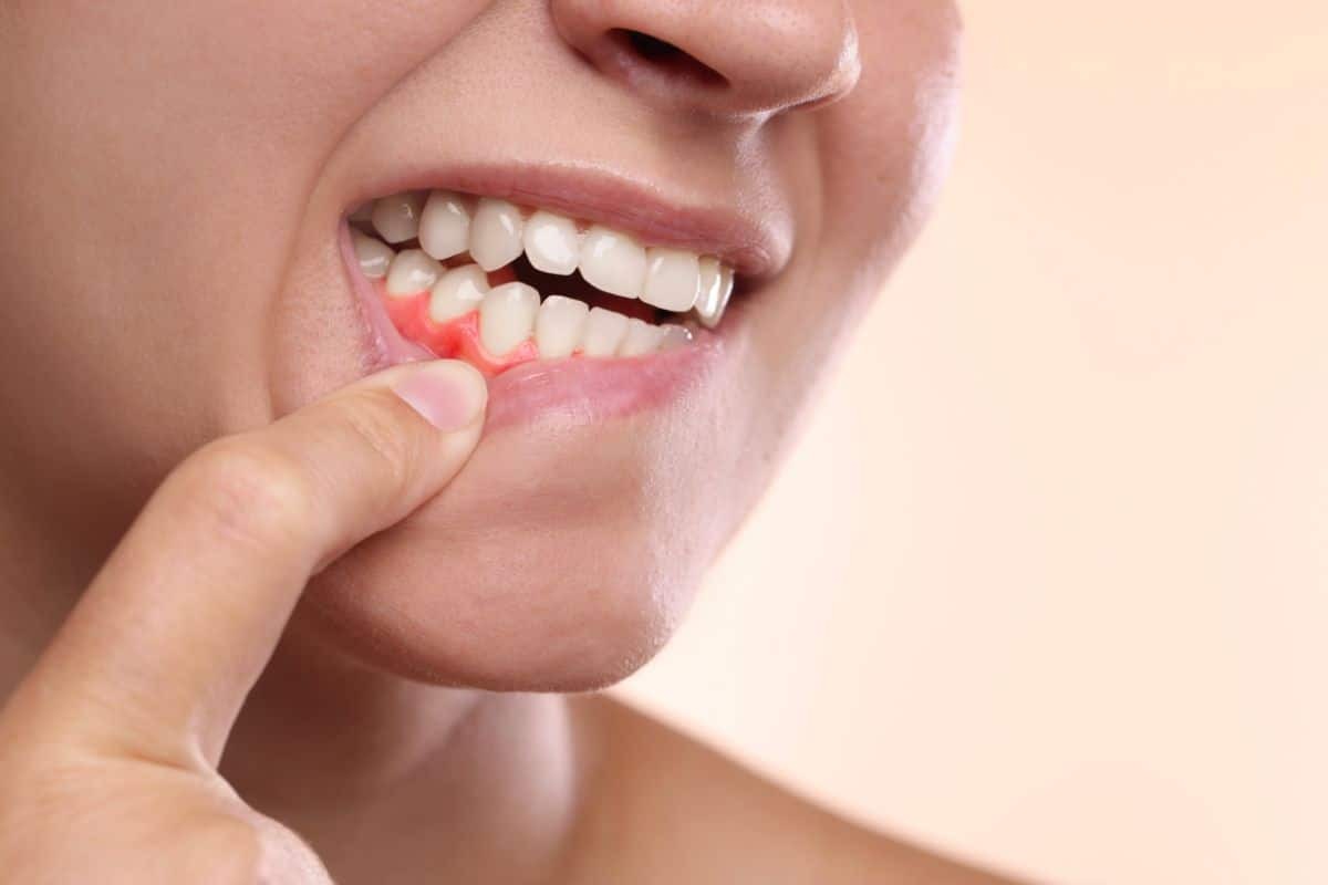 Featured image for “Why Gum Disease Is So Common Among Portland Adults—and How to Stop It Early”