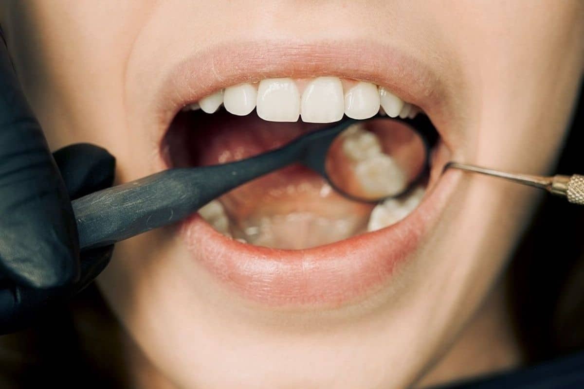 Featured image for “How Long Until a Tooth Infection Kills You? Warning Signs You Should Never Ignore”